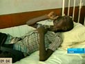Тревога в США: больной редким видом туберкулеза мог заразить сотни человек в США, Канаде и Европе