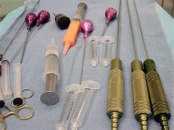 Инструменты для липоксации. Фото с сайта liposuction4you.com