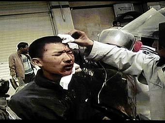 Раненый участниц демонстрации. Кадр телеканала CCTV, переданный AFP